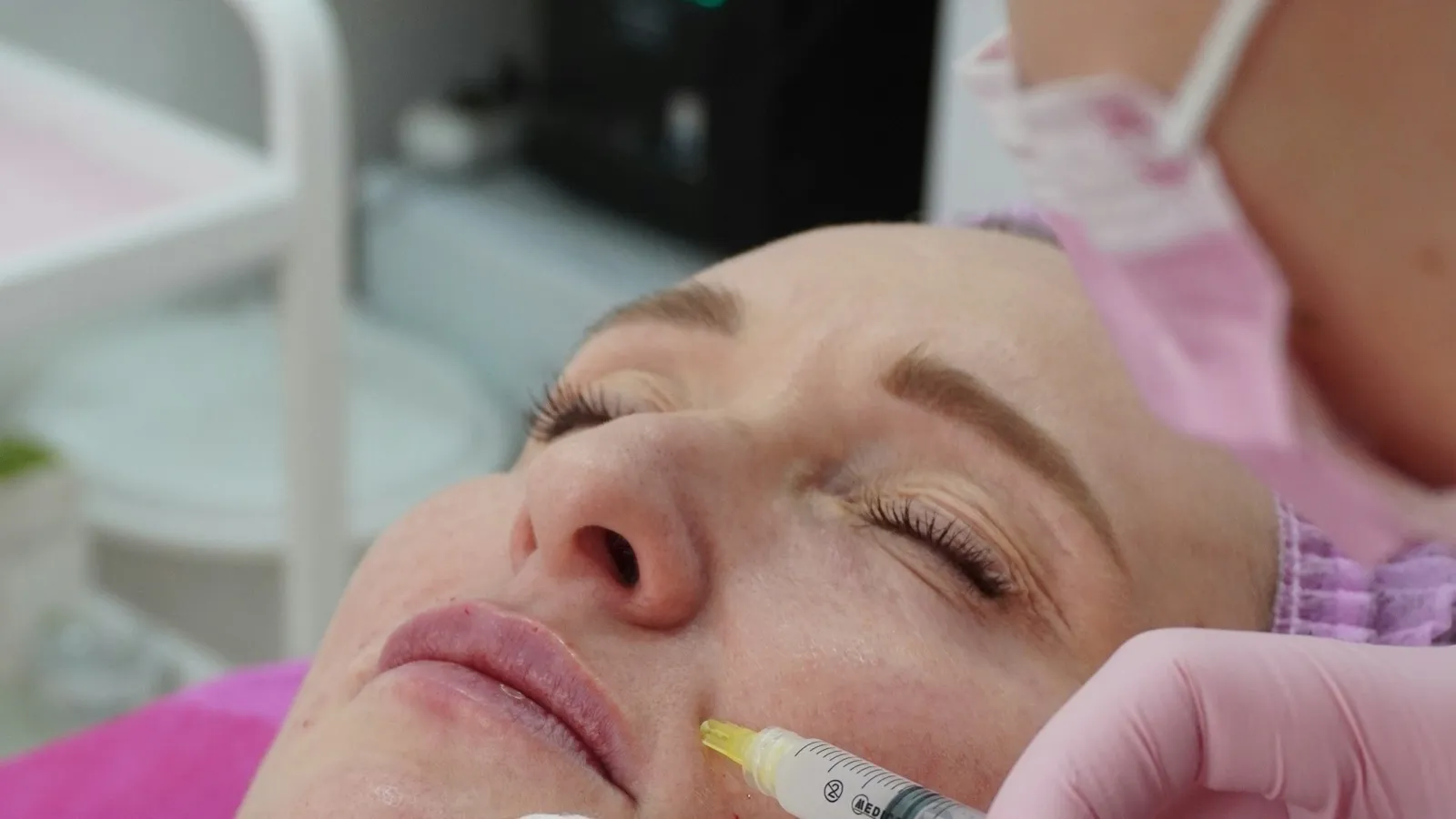 Provider performing a dermal filler injection near the lips
