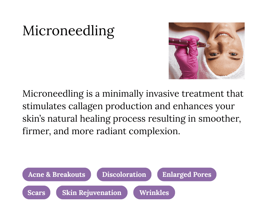 Aetheria Aesthetics Treatment Card Microneedling 829089c4